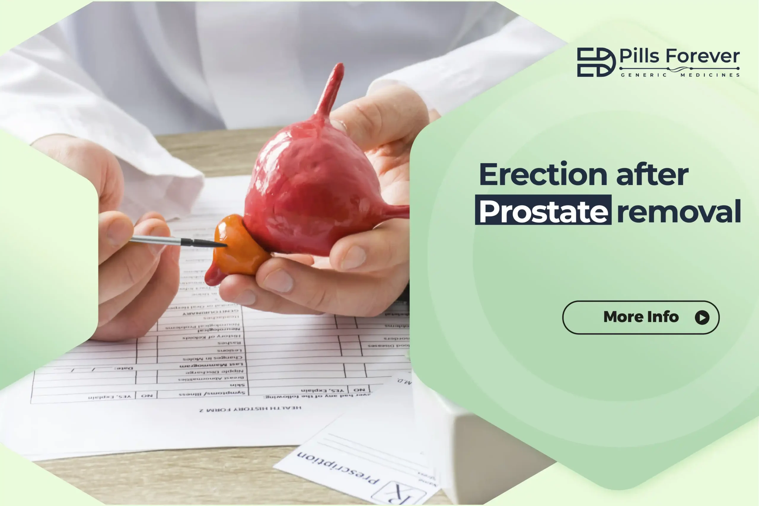 Erection after prostate removal