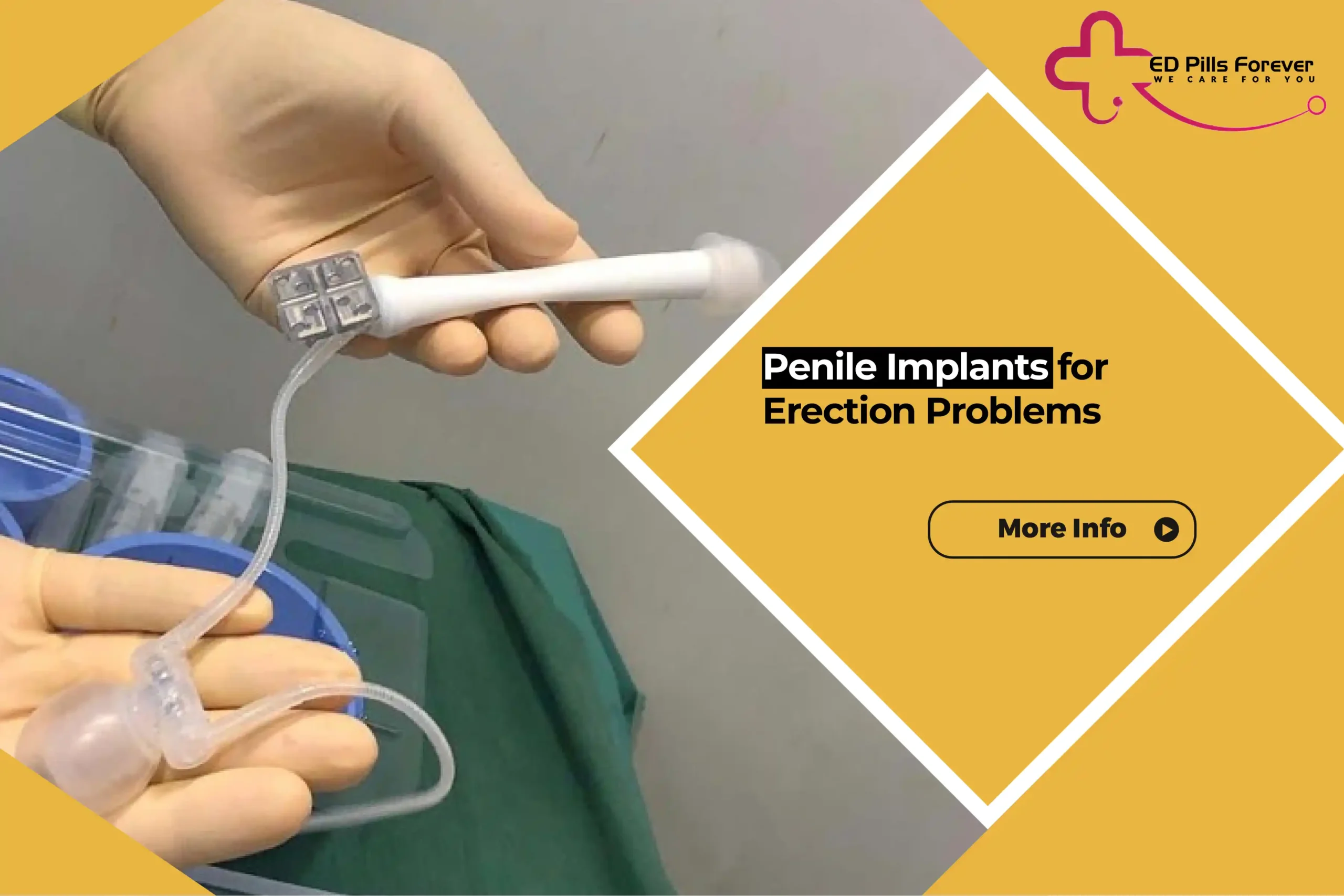 penile implants