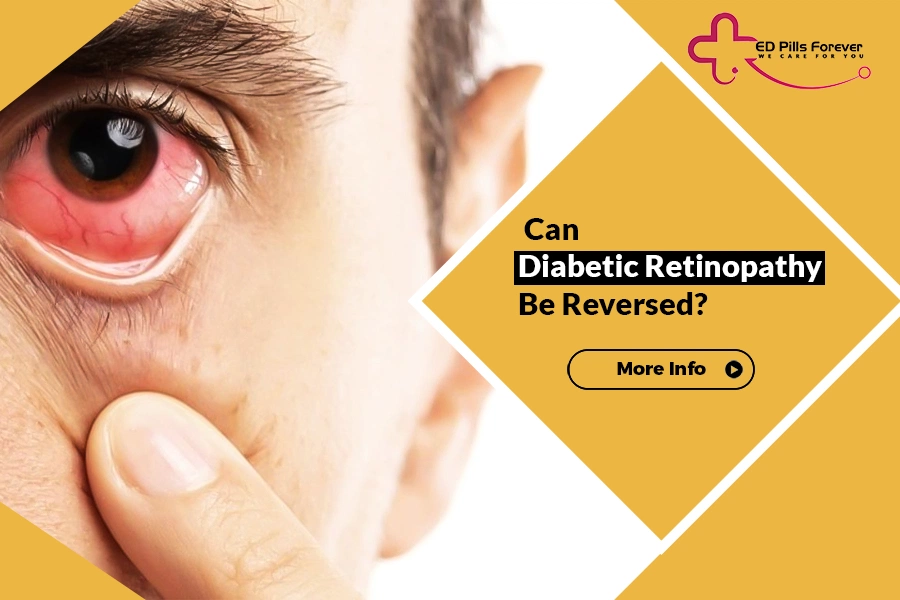 diabetic retinopathy can be reversed