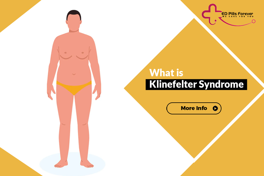 What is Klinefelter syndrome 2