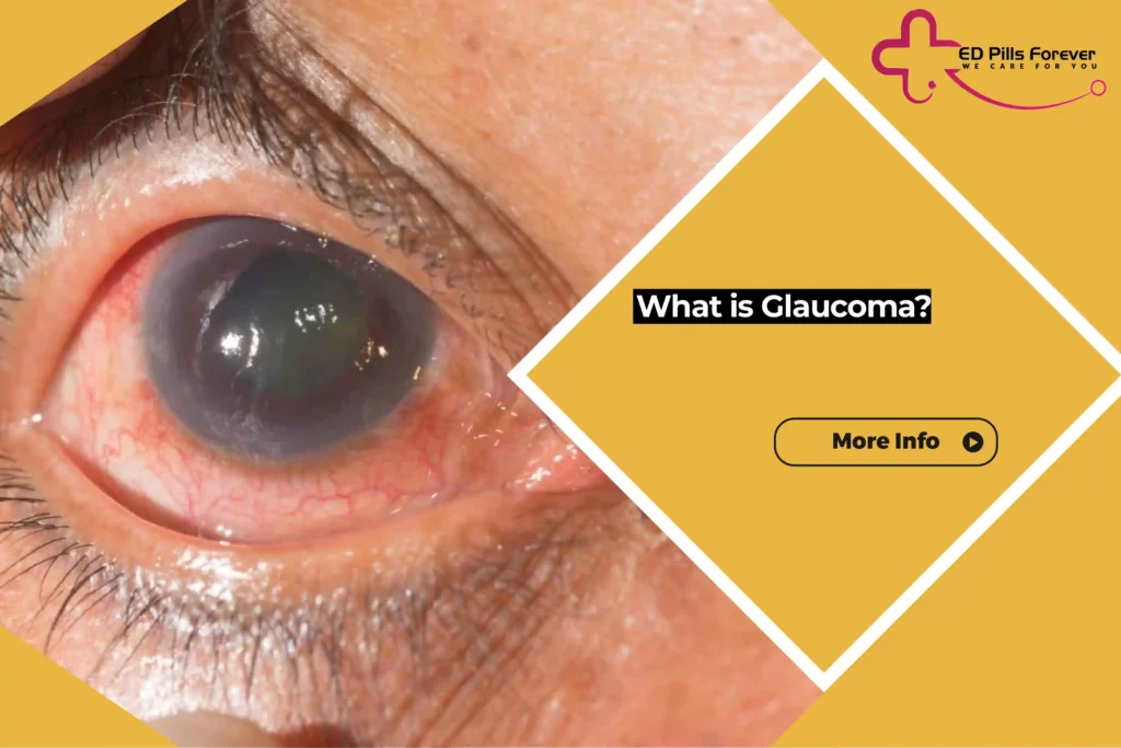 What is Glaucoma