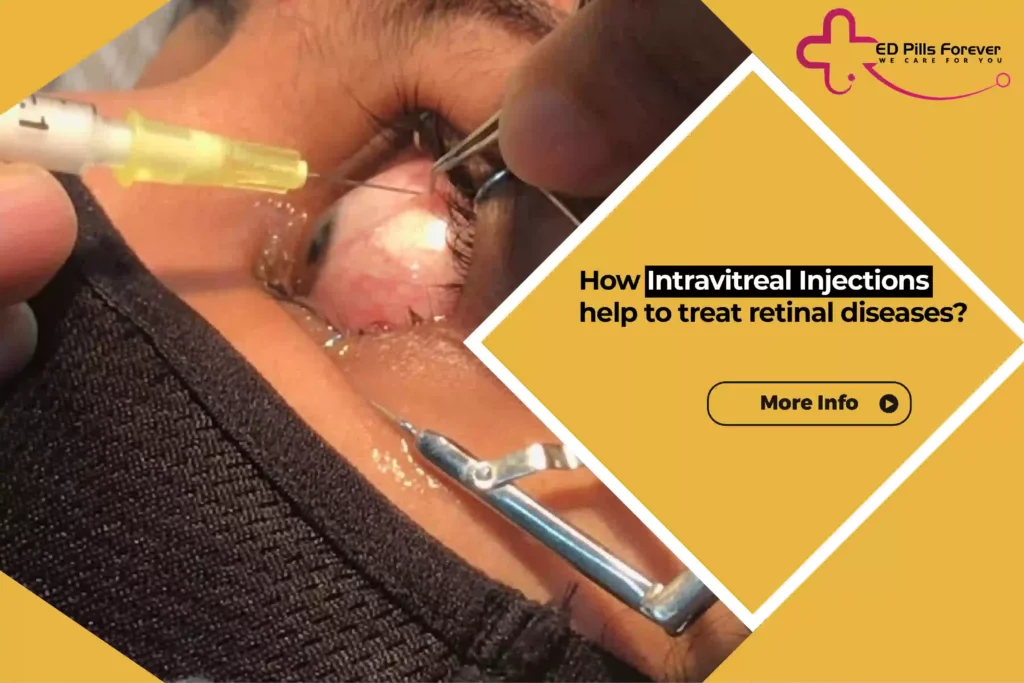 Intravitreal injection procedure
