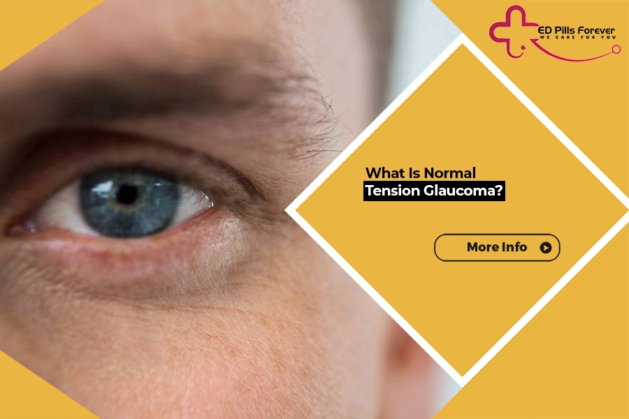 Illustration showing optic nerve damage in normal-tension glaucoma