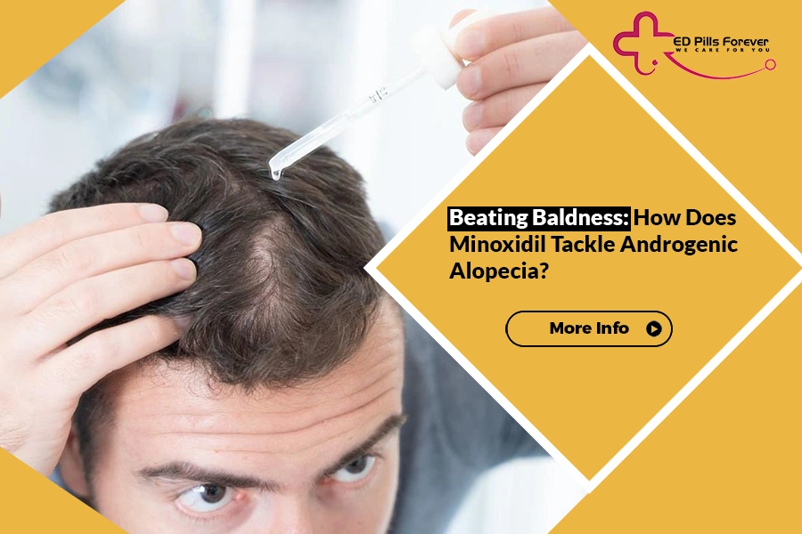 Man applying minoxidil for pattern baldness