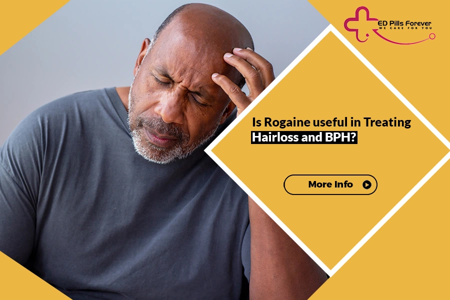 Man with hair loss concern