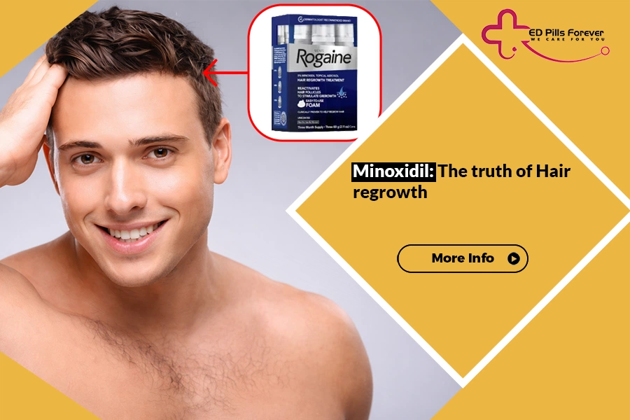 Man pointing at thinning hair with Rogaine.