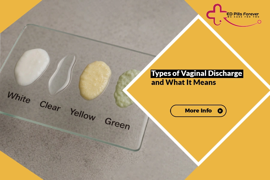 Types of Vaginal Discharge and What It Means