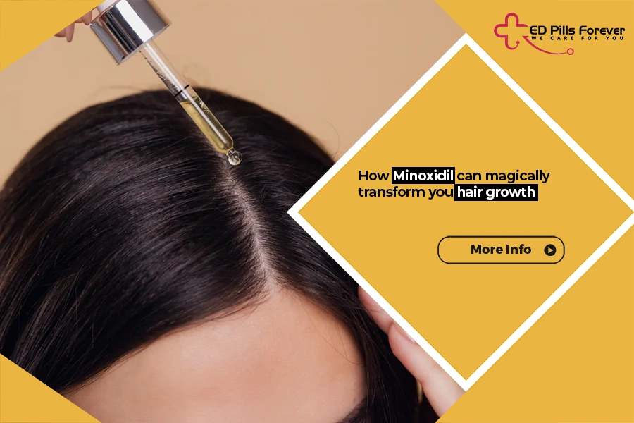 Minoxidil transform your hair growth