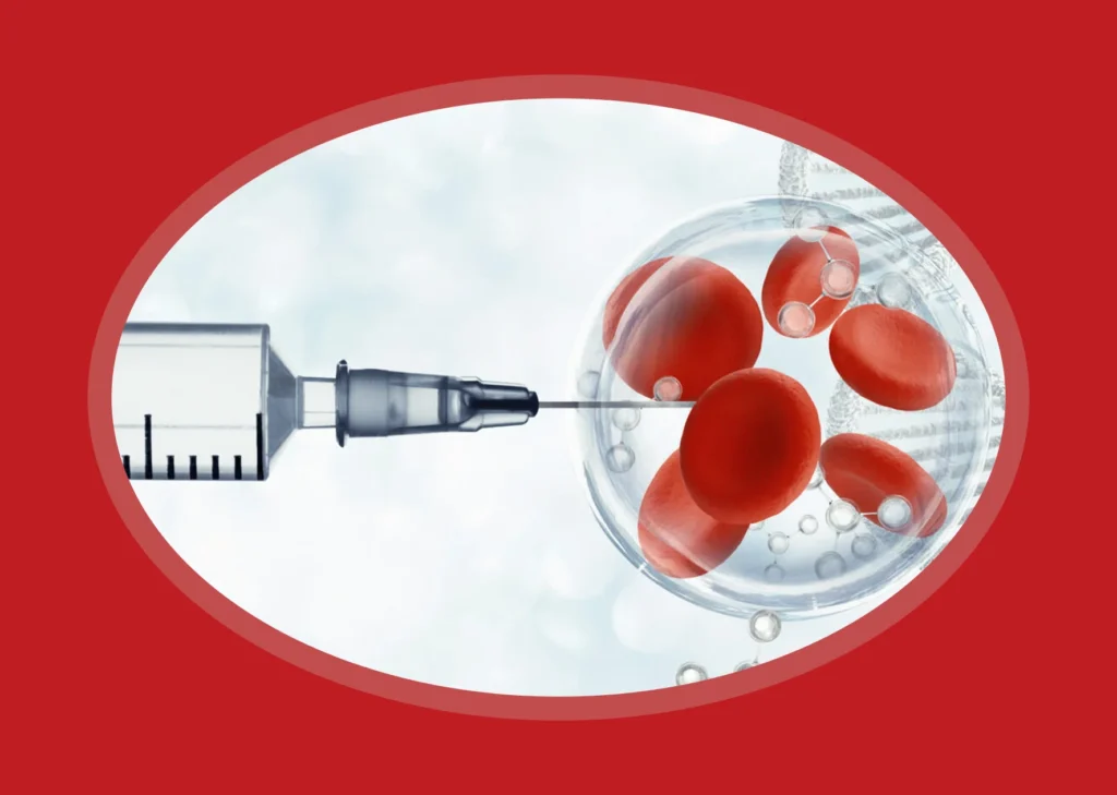 Injection therapy for erectile dysfunction treatment.