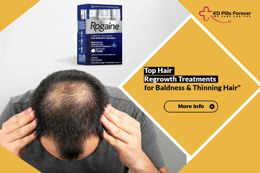 regrowth treatment for baldness