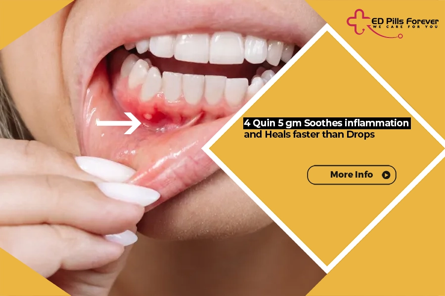 4 Quin 5 gm Soothes inflammation and Heals faster than Drops