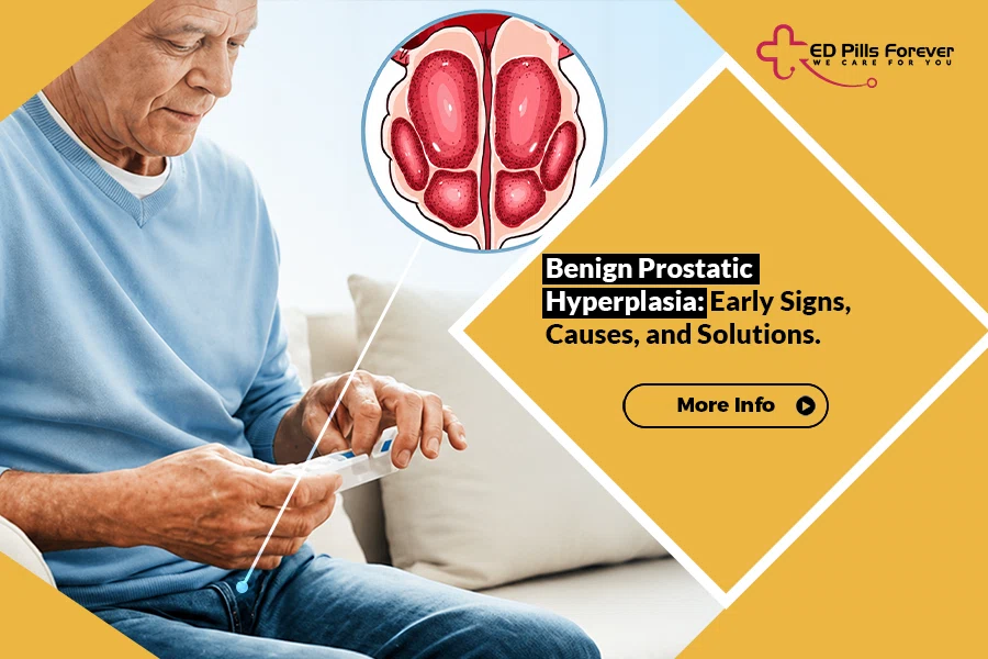 Benign Prostatic Hyperplasia Signs, Causes And Solutions