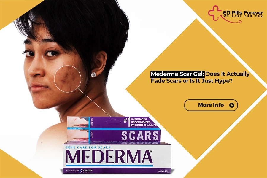 Mederma Scar Gel for fading acne scars – Does it actually work?