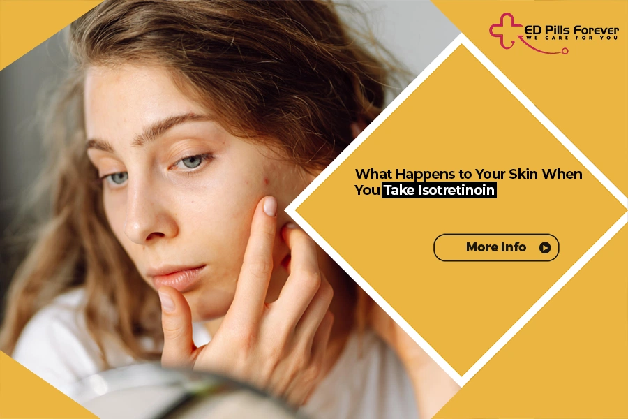 Isotretinoin Acne Treatment Effects