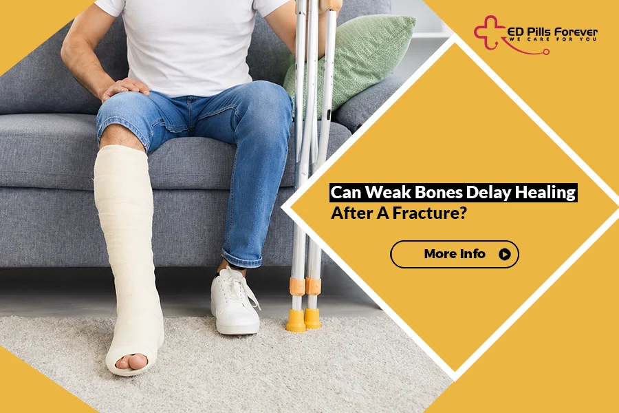 Person recovering from a leg fracture with a cast and crutches, illustrating how Weak Bones may affect healing.