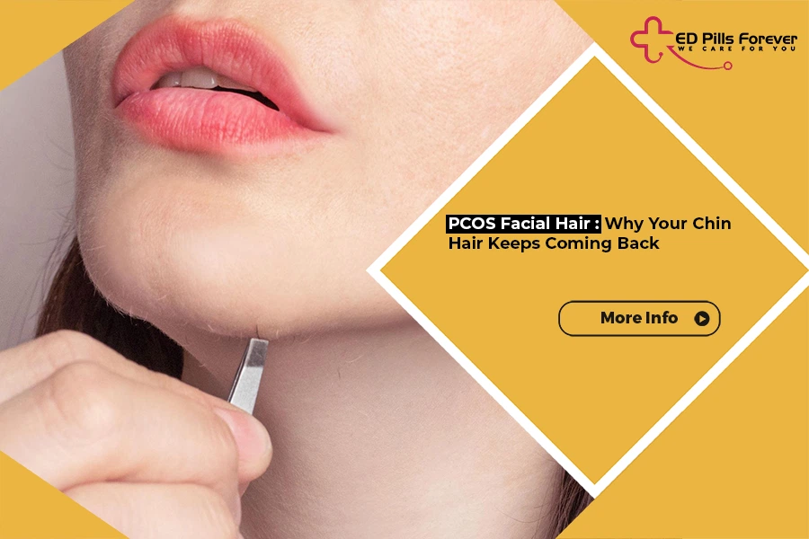 PCOS Facial Hair
